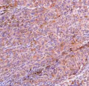 Anti-MAGE 1 antibody used in IHC (Paraffin sections) (IHC-P). GTX16031